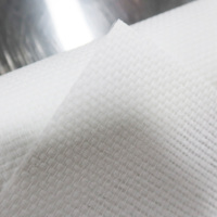 Pelapis Dinding Fiberglass Antimikroba Bio-Safe untuk Klinik Gigi dan Pusat Perawatan Lansia