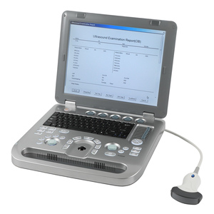 Échographe portable 2D/3D de diagnostic médical électrique de haute qualité - Product Image 3