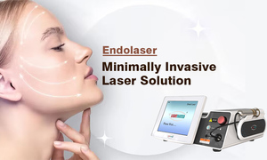 อุปกรณ์ฉีดสลายไขมัน2025ให้ผิวด้วยเอนโดสลิมทำให้ผิวบางลงการดูดไขมันด้วยเส้นใย1470nm 980nm - Product Image 2