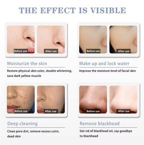 Boîte magique portable, petite machine de soin de la peau à bulles pour un nettoyage en profondeur des pores, l'<span class=keywords><strong>extraction</strong></span> des points noirs et le rajeunissement de la peau - Product Image 2