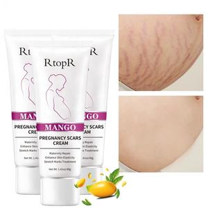 <span class=keywords><strong>Crema</strong></span> RtopR al Mango <span class=keywords><strong>per</strong></span> il Trattamento Efficace di Smagliature e <span class=keywords><strong>Cicatrici</strong></span> da Gravidanza <span class=keywords><strong>per</strong></span> la Cura della Pelle del Corpo - Product Image 4