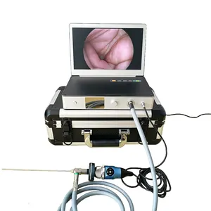Medical endoscope camera system Full HD with 11.6 inch/15.6inch monitor, 30W/100W LED light source and HD recorder