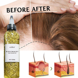 Aceite para el Crecimiento del Cabello Orgánico Natural al por Mayor, Cuidado del Cuero Cabelludo, Aceite de Romero para el Crecimiento del Cabello - Product Image 3