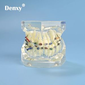 Denxy-modelo de ortodoncia para ortodoncia Dental, modelo principal transparente extraíble, soporte de Metal transparente, ligadura, atado de dientes - Product Image 4