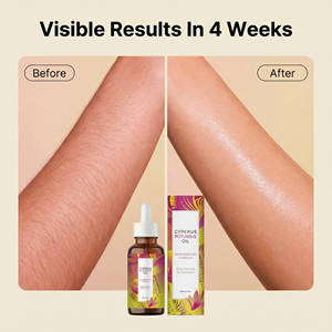 Aceite de Cyperus Rotundus 100% Natural al por Mayor para Cuerpo y Rostro, Reduce Poros, Elimina el Vello, Inhibidor del Crecimiento del Vello a Largo Plazo - Product Image 3