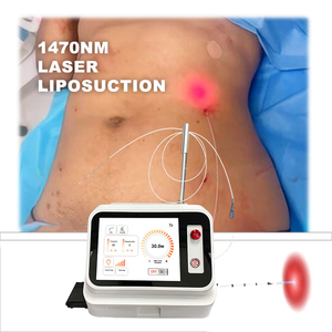 Endolifting con Láser Endolift de 980nm y 1470nm para Várices en Rostro y Cuerpo - Product Image 4