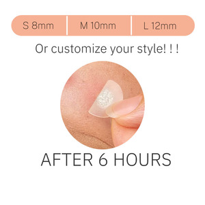 Perawatan Kulit Bebas Kekejaman Hewan, Menyerap Cairan dan Mengurangi Peradangan, Plester Jerawat Hidrokoloid Bentuk Bintang - Product Image 2