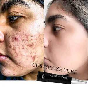 Vendita all'ingrosso crema per il viso sbiancante macchia scura cicatrice-Cicatrice per il trattamento dell'acne rimuovere la cura della pelle cosmetica OEM rimozione del punto scuro lozione di canapa crema schiarente per l'acne schiarente per l'acne