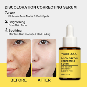 Sérum correcteur de <span class=keywords><strong>décoloration</strong></span> OEM/ODM, traitement des taches brunes avec Centella, Niacinamide pour l'essence de vitamine, base de maquillage - Product Image 4