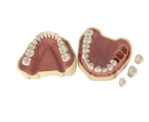 Model Gigi Manusia Pengganti <span class=keywords><strong>Typodont</strong></span> Anatomi Manusia, Model Gigi Palsu Praktis untuk Ortodonti, Model Gigi untuk Frasaco ANA4 - Product Image 2