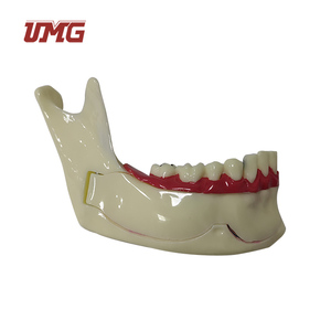 Modello di decomposizione dentale organizzazione modello di mandibola Od - Product Image 6