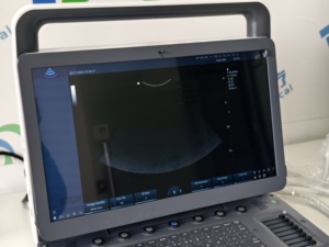 Échographe Doppler Couleur Portable Zoncare M30 avec Imagerie Élastographique pour Examen Cardiaque et Réproductif Vétérinaire - Product Image 3
