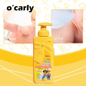 Lotion Corporelle Hydratante et Éclaircissante Personnalisée OEM <span class=keywords><strong>Prince</strong></span> à la Glycérine et à l'Huile de Camomille pour Bébé - Product Image 2