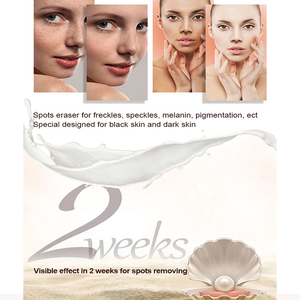 Crema blanqueadora de perlas de oro blanco de 24 quilates para eliminar pecas Royal Expert <span class=keywords><strong>Aloe</strong></span> <span class=keywords><strong>Vera</strong></span>, crema blanqueadora facial para eliminar manchas oscuras de Italia - Product Image 4