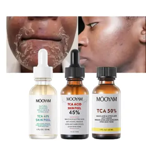 Produk Kecantikan 40% 45% 50% TCA peremajaan kulit kimia Anti penuaan perawatan jerawat Anti Keriput TCA serum perawatan kulit wajah pengelupas