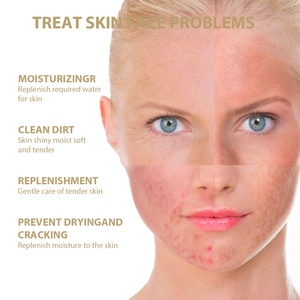 Soins de la peau coréens personnalisés, éclaircissement de l'acné, blanchiment, apaisement, hydratation, tonique pour le visage à la nicotinamide et au riz - Product Image 4