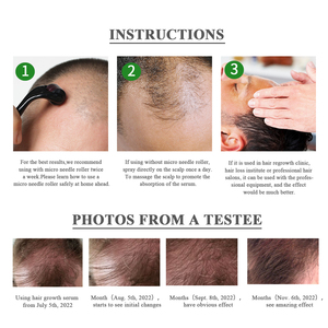 Sérum capillaire pour le cuir chevelu en marque privée, traitement fortifiant et épaississant pour les cheveux, OEM ODM - Product Image 5