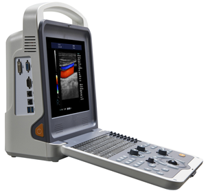 Mesin USG Doppler Warna Portabel MSLCU28, Pemindai USG Digital <span class=keywords><strong>Laptop</strong></span> - Product Image 2