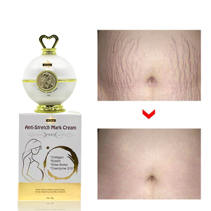 Huile et Crème OEM Naturelles Apaisantes Sûres et Efficaces pour l'Élimination des Vergetures, Réparation Rapide des Vergetures Corporelles - Product Image 6