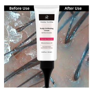 Proveedor Mayorista de Crema Exfoliante para <span class=keywords><strong>el</strong></span> <span class=keywords><strong>Cuero</strong></span> <span class=keywords><strong>Cabelludo</strong></span> de 100 ml, Limpia, Nutre y Mejora la Circulación del <span class=keywords><strong>Cuero</strong></span> <span class=keywords><strong>Cabelludo</strong></span> - Product Image 3