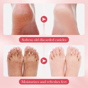 Maschera Esfoliante e Nutriente per <span class=keywords><strong>Piedi</strong></span> 35g al Gusto Pesca, Ciliegia e Aloe con Niacinamide per Pelle Morta e <span class=keywords><strong>Calli</strong></span> - Product Image 6