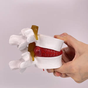 Lumbar Spine Model Intervertebral Disc Model Diseased Lumbar Spine Model - Product Image 6