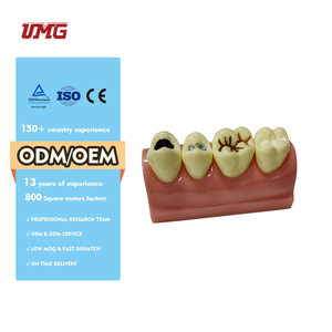 Sealant and <strong>Inlay</strong> Demonstration <strong>Teeth</strong> Model for Patient Education - Product Image 3