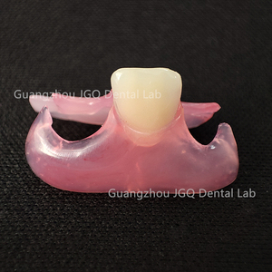 Prothèse <span class=keywords><strong>dentaire</strong></span> durable à <span class=keywords><strong>prix</strong></span> avantageux, base rose Valplast, prothèses flexibles amovibles, laboratoire <span class=keywords><strong>dentaire</strong></span> chinois, meilleure qualité - Product Image 2