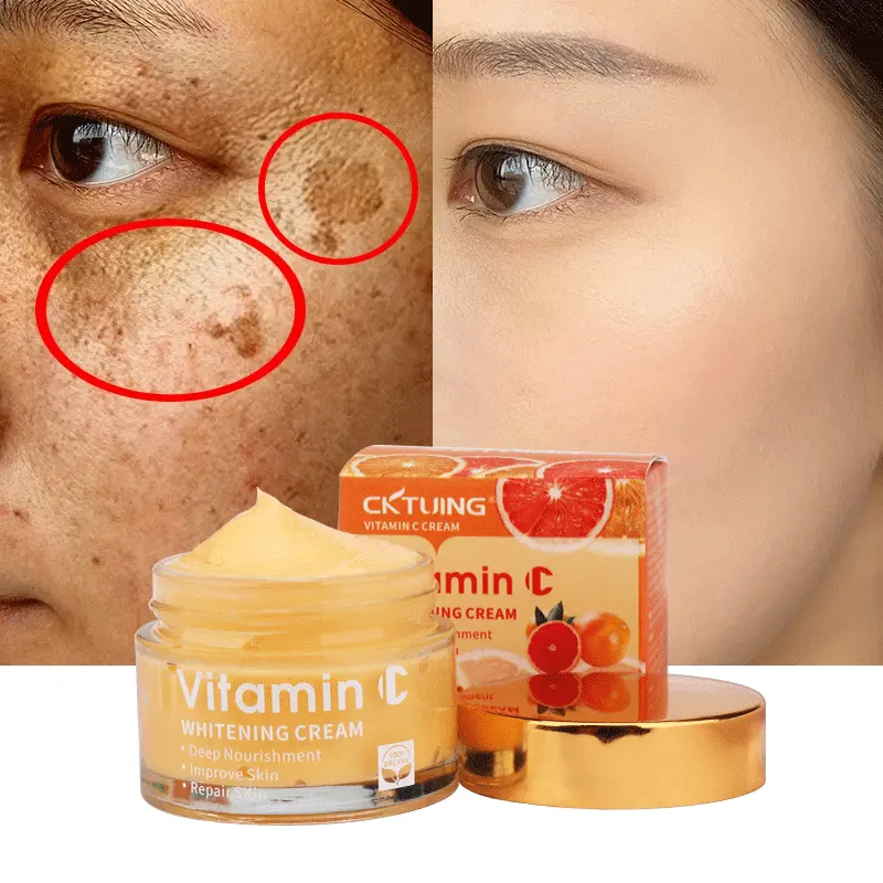 Großhandel Bio Vitamin C Bleichen White ning Anti-Aging Akne Sommersprossen dunklen Fleck Korrektor Entferner Gesichts creme