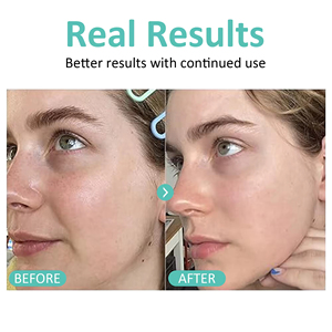 निजी लेबल फेरुलिक एसिड विटामिन सी विटामिन सी सीरम मॉइस्चराइजिंग मरम्मत की मरम्मत शुष्क त्वचा के लिए एंटी-एजिंग सफेदी - Product Image 3