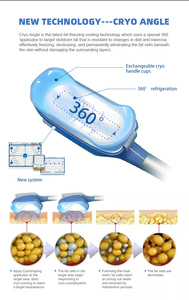 เครื่องแช่แข็งไขมันด้วยความเย็นแบบใหม่ พร้อมหัวจับ 5 หัว สำหรับการสลายไขมันและกระชับสัดส่วนด้วยความเย็น - Product Image 3