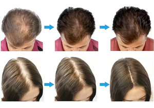 Bestseller Neues Design Haar Kopfhaut behandlungs maschine Follikel erkennungs analyze Haarwuchs Kopfhaut massage 5 in 1 für Hair Spa - Product Image 6