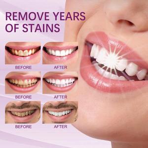 <span class=keywords><strong>EELHOE</strong></span> Venta al por Mayor Marca Privada 30ML <span class=keywords><strong>Corrector</strong></span> de Color Dental con Extracto Natural V34 Mousse Blanqueador de Dientes Morado para Limpiar Manchas - Product Image 6