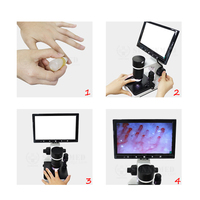 SY-B198 Cheapest Teaching Use Finger Capillary Microscope for Medical School