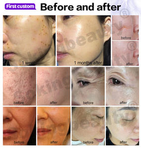 Appareil de plasma froid et chaud supérieur 9 en 1 pour lutter contre le vieillissement, réduire les rides, soigner l'acné et raffermir la peau - Product Image 6