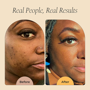 Gommage exfoliant pour le visage et le corps au sel, à l'huile de jojoba et au curcuma biologique végétalien personnalisé, éclaircissant les taches brunes - Product Image 4