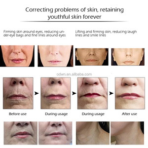 Vente chaude OEM 60 Secondes <span class=keywords><strong>Crème</strong></span> <span class=keywords><strong>Anti</strong></span>-<span class=keywords><strong>Rides</strong></span> Instantanée pour les Yeux avec Effet Visible - Product Image 6