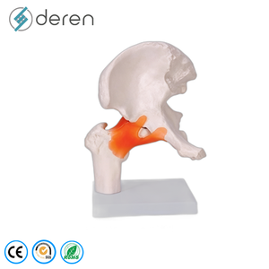 Ensemble de 4 modèles pathologiques de l'articulation du genou, modèle d'anatomie du genou en stade d'<span class=keywords><strong>arthrose</strong></span> pour l'enseignement médical - Product Image 4