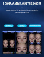 Analizador de Piel y Cabello 2 en 1, Dispositivo de Análisis Facial y del Cuero Cabelludo con Tecnología IA, Material ABS, Herramienta Portátil para el Cuidado de la Piel