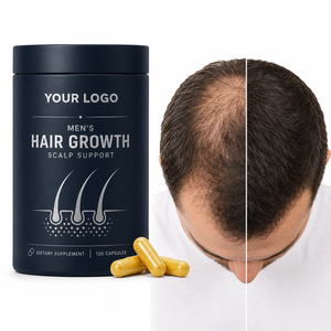 Cápsulas para el Cabello para Hombres OEM, Biotina, Zinc, Selenio, Colágeno, Densidad del Cuero Cabelludo, Vitaminas A, C, D, E, Suplemento Natural de Nutrición Diaria - Product Image 1
