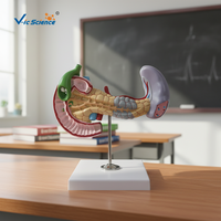 Modelo de anatomía del cuerpo humano, enfermedades del páncreas y la médula, modelo de enseñanza médica patológica
