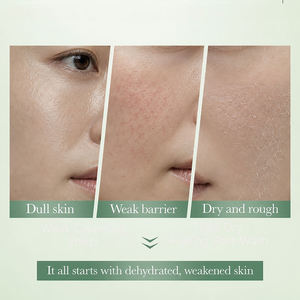 Soins de la peau liquides en marque privée avec céramide NP, niacinamide, antioxydant, antibactérien et anti-acné pour tous types de peau OEM/ODM - Product Image 3