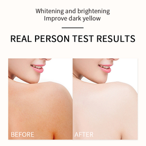 สบู่ล้างหน้าร่างกายเพื่อความขาวกระจ่างใสวิตามินโรสฮิปสเตอร์ว่านหางจระเข้จากประเทศจีน - Product Image 5