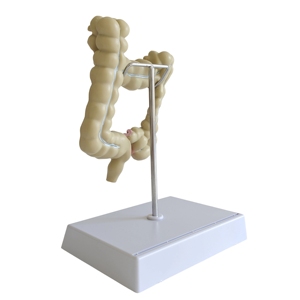 Modèle pathologique du côlon humain, modèle anatomique de l'intestin large - Product Image 6
