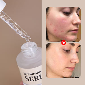 Sérum Coréen Hydratant Anti-Âge et Raffermissant de Nuit à la Niacinamide et à l'Acide Salicylique pour un Effet Lifting Instantané - Product Image 3