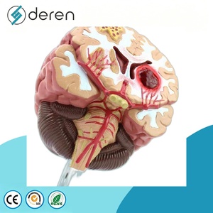 Modelo de Cerebro para Epilepsia Tipo Maniquí, Material PLA, para Hemorragia Cerebral, Malformación Arteriovenosa, Patología - Product Image 4