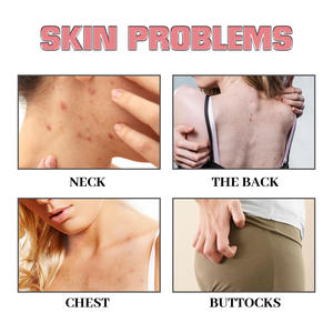 เคราตินกำจัดสิวคุณภาพสูงช่วยลดรอยสิวและให้ความชุ่มชื้นกับสบู่ทำความสะอาดผิว - Product Image 6