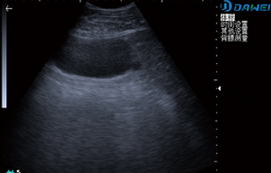 Ecógrafo Veterinario Portátil para Animales Dawei a Precio Competitivo - Product Image 6