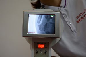कम खुराक उच्च सटीकता फ्लोरोस्कोपिक पोर्टेबल एक्स-रे मशीन पशु चिकित्सा चरम के लिए हाथ कलाई पैर के पॉडिएट्रिस्ट उपकरण - Product Image 5