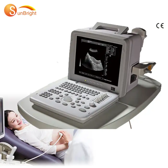 Goedkope Ecograph Laptop Medische Zwart-wit Ultrasound Scan Machine
